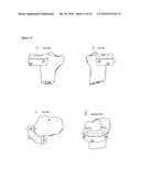 SURGICAL TEMPLATES diagram and image