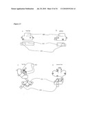 SURGICAL TEMPLATES diagram and image