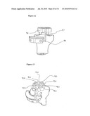 SURGICAL TEMPLATES diagram and image