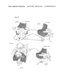 SURGICAL TEMPLATES diagram and image