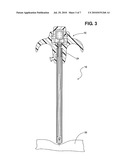 VERESS NEEDLE WITH ILLUMINATED GUIDANCE AND SUTURING CAPABILITY diagram and image