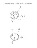 Set for Producing a Resurfacing Hip Implant diagram and image