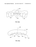 METHODS, APPARATUS AND SYSTEM FOR USE IN DENTAL PROCEDURES diagram and image