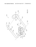 METHODS, APPARATUS AND SYSTEM FOR USE IN DENTAL PROCEDURES diagram and image