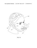 METHODS, APPARATUS AND SYSTEM FOR USE IN DENTAL PROCEDURES diagram and image