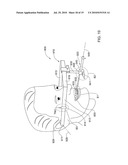 METHODS, APPARATUS AND SYSTEM FOR USE IN DENTAL PROCEDURES diagram and image