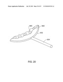 METHODS, APPARATUS AND SYSTEM FOR USE IN DENTAL PROCEDURES diagram and image