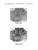 SYSTEM AND METHOD FOR USING THREE DIMENSIONAL INFRARED IMAGING FOR LIBRARIES OF STANDARDIZED MEDICAL IMAGERY diagram and image