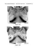 SYSTEM AND METHOD FOR USING THREE DIMENSIONAL INFRARED IMAGING FOR LIBRARIES OF STANDARDIZED MEDICAL IMAGERY diagram and image