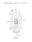 SYSTEM AND METHOD FOR USING THREE DIMENSIONAL INFRARED IMAGING FOR LIBRARIES OF STANDARDIZED MEDICAL IMAGERY diagram and image