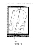 SYSTEM AND METHOD FOR USING THREE DIMENSIONAL INFRARED IMAGING FOR LIBRARIES OF STANDARDIZED MEDICAL IMAGERY diagram and image