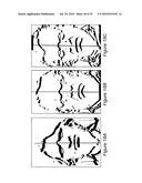 SYSTEM AND METHOD FOR USING THREE DIMENSIONAL INFRARED IMAGING FOR LIBRARIES OF STANDARDIZED MEDICAL IMAGERY diagram and image