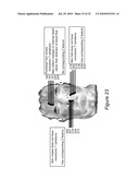 SYSTEM AND METHOD FOR USING THREE DIMENSIONAL INFRARED IMAGING FOR LIBRARIES OF STANDARDIZED MEDICAL IMAGERY diagram and image