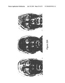 SYSTEM AND METHOD FOR USING THREE DIMENSIONAL INFRARED IMAGING FOR LIBRARIES OF STANDARDIZED MEDICAL IMAGERY diagram and image