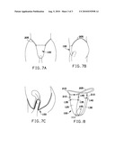 PROPHYLACTIC DEVICE FOR USE DURING INTERCOURSE diagram and image