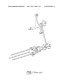 TRACKABLE REFERENCE DEVICE FOR COMPUTER-ASSISTED SURGERY diagram and image