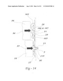 COMBINATION UNIT DOSE DISPENSING CONTAINERS diagram and image