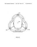 Transducer Array Arrangement and Operation for Sodar Application diagram and image