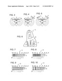 HEARING AID WITH INTERFERENCE COMPENSATION AND METHOD FOR CONFIGURATING THE HEARING AID diagram and image