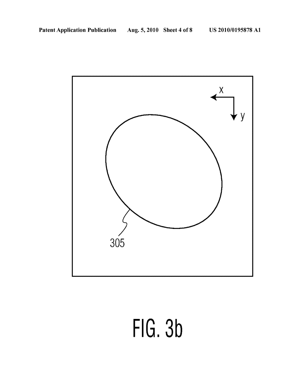 SYSTEMS AND METHODS FOR LABELING 3-D VOLUME IMAGES ON A 2-D DISPLAY OF AN ULTRASONIC IMAGING SYSTEM - diagram, schematic, and image 05