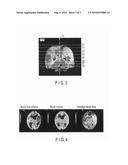 MEDICAL IMAGE PROCESSING APPARATUS diagram and image
