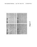 ISCHEMIA/REPERFUSION PROTECTION COMPOSITIONS AND METHODS OF USING diagram and image