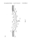 ADJUSTABLE SURGICAL SLING diagram and image