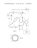 Systems and methods for optimizing and maintaining visualization of a surgical field during the use of surgical scopes diagram and image