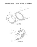 Systems and methods for optimizing and maintaining visualization of a surgical field during the use of surgical scopes diagram and image