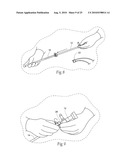 Systems and methods for optimizing and maintaining visualization of a surgical field during the use of surgical scopes diagram and image