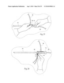 Systems and methods for optimizing and maintaining visualization of a surgical field during the use of surgical scopes diagram and image