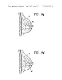 REMOTELY ACTIVATED MARKER diagram and image