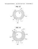 Method and Device for Obtaining Tissue Samples diagram and image