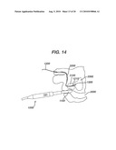 Method and Device for Obtaining Tissue Samples diagram and image