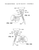 Method and Device for Obtaining Tissue Samples diagram and image