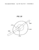 Method and Device for Obtaining Tissue Samples diagram and image