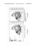 ULTRASONIC DIAGNOSTIC APPARATUS, ULTRASONIC IMAGE PROCESSING APPARATUS, MEDICAL IMAGE DIAGNOSTIC APPARATUS, MEDICAL IMAGE PROCESSING APPARATUS, ULTRASONIC IMAGE PROCESSING METHOD, AND MEDICAL IMAGE PROCESSING METHOD diagram and image