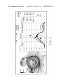 ULTRASONIC DIAGNOSTIC APPARATUS, ULTRASONIC IMAGE PROCESSING APPARATUS, MEDICAL IMAGE DIAGNOSTIC APPARATUS, MEDICAL IMAGE PROCESSING APPARATUS, ULTRASONIC IMAGE PROCESSING METHOD, AND MEDICAL IMAGE PROCESSING METHOD diagram and image