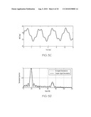 Random Body Movement Cancellation for Non-Contact Vital Sign Detection diagram and image