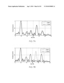 Random Body Movement Cancellation for Non-Contact Vital Sign Detection diagram and image