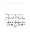 SENSOR COMPRISING A MATERIAL WHICH GENERATES AN ELECTRICAL SIGNAL IN RESPONSE TO ELONGATION diagram and image