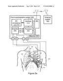 METHODS AND SYSTEMS FOR PUMPING FLUIDS diagram and image