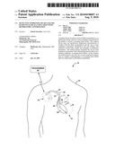 DETECTING WORSENING HEART FAILURE BASED ON FLUID ACCUMULATION WITH RESPIRATORY CONFIRMATION diagram and image