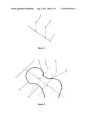 METHOD AND DEVICE FOR DETERMINING A CHARACTERISTIC PROPERTY OF AN ANATOMICAL STRUCTURE diagram and image