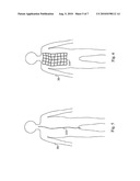 PATIENT MONITORING AT RADIATION MACHINES diagram and image