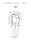 FEMORAL SUPPORT MEMBER FOR A WALKING ASSISTANCE DEVICE diagram and image