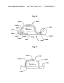 Augmenting force-delivery in belt-type ECM devices diagram and image