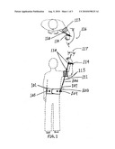 Manageable Arm and Hand Elevation Device diagram and image