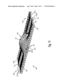 FLEXIBLE STRUCTURAL APPARATUS, SPRING, WOUND COVERING, AND METHODS diagram and image