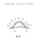 FLEXIBLE STRUCTURAL APPARATUS, SPRING, WOUND COVERING, AND METHODS diagram and image